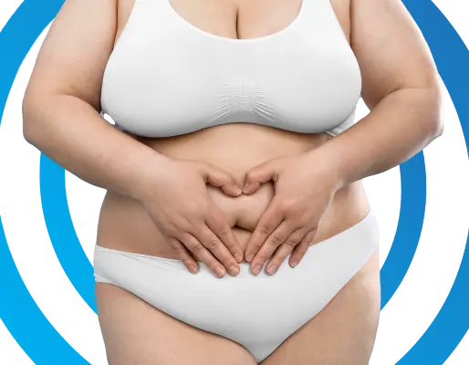 Bariatric Surgery