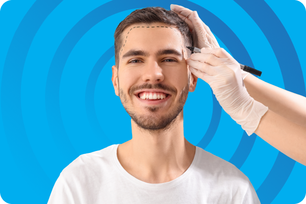 FUE Hair Transplant