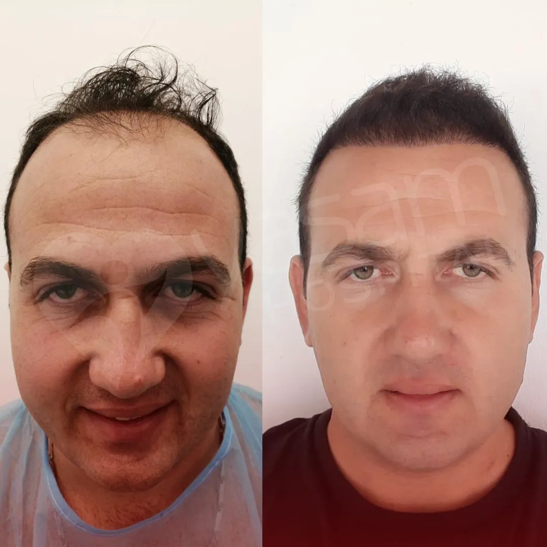 Before & After