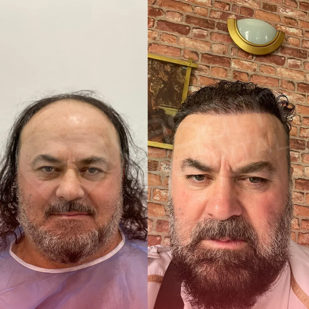 Before & After