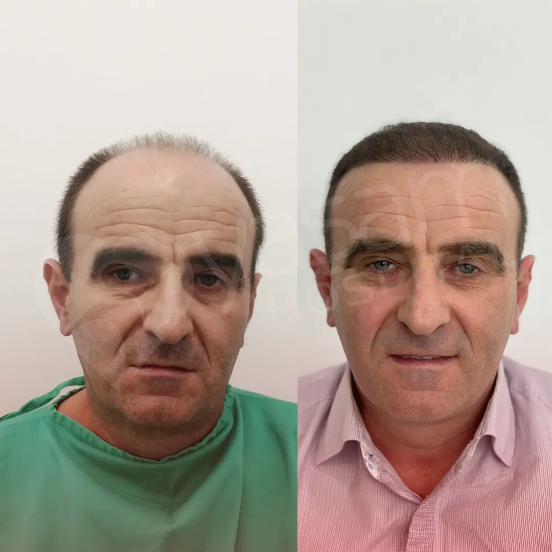 Before & After