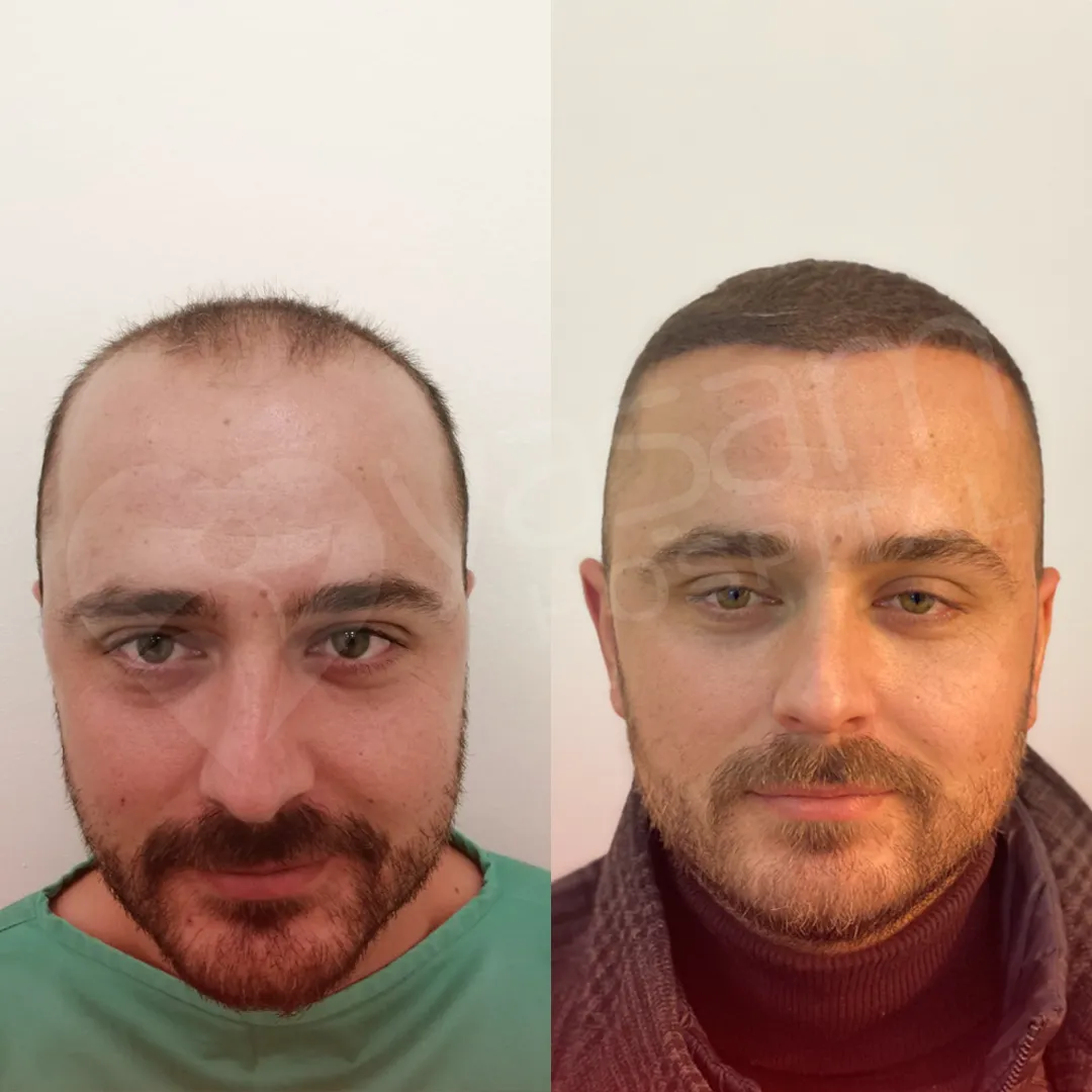 Before & After